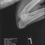 ofa elbow x-ray